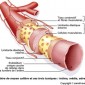 Définition d’artère